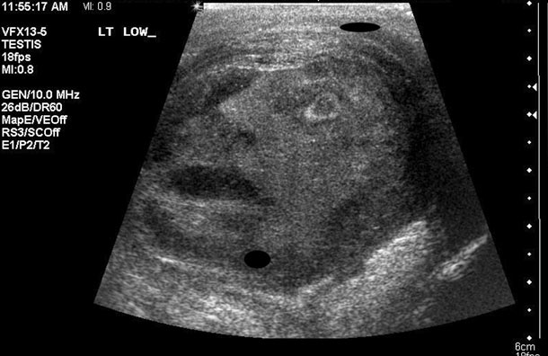 ultrasound-image-of-a-man-s-testicle-shows-a-the-outline-of-a-human-face-pic-splash-82601204